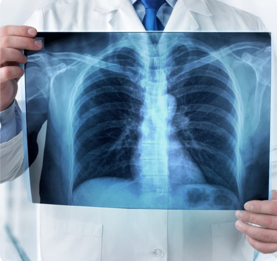 X-RAY